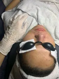 Chăm sóc da chuyên sâu