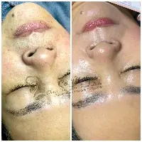 Thải độc da, thanh lọc da đa tầng