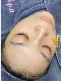 Nuôi da đa tầng màng sinh học căng bóng