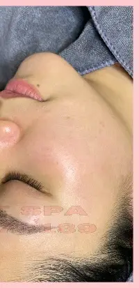 Vi sinh tảo đỏ
