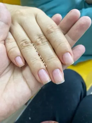Làm sạch da chết