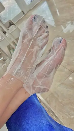 Chà gót chân + ủ VitaminE