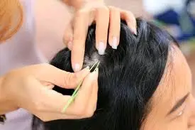 Nhỗ tóc bạc _tóc ngứa