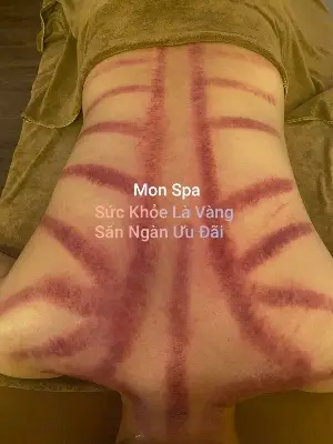 Intensive Neck & Shoulder Massage