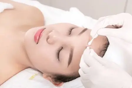 LẤY NHÂN MỤN CHUẨN Y KHOA