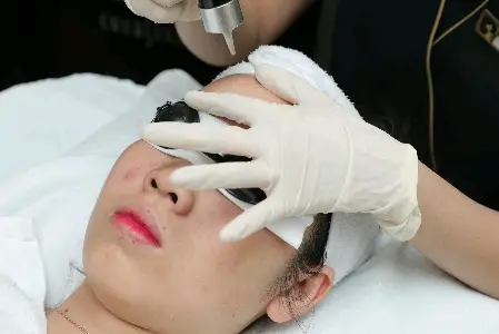 Laser Cacbon