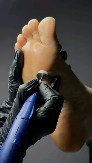 Cracked Heel Combo