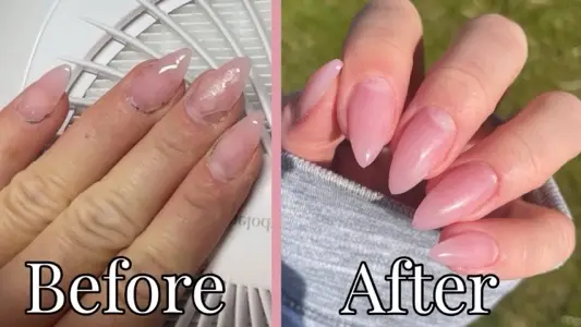 Fill gel