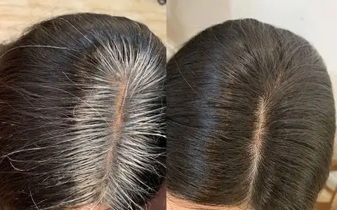 Nhuộm phủ bạc tóc ngắn
