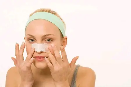 Blackhead Removal