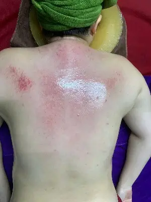 Đả Thông Dds - 30 phút