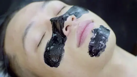 Blackhead Removal
