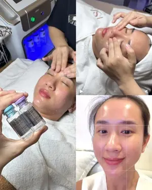 Cold Algae Peel (Christina) – Deep Exfoliation