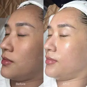 Cold Algae Peel (Christina)