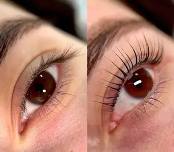 Uốn Mi - Curling Lashes