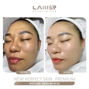 Advanced Acne Facial – 14 Steps