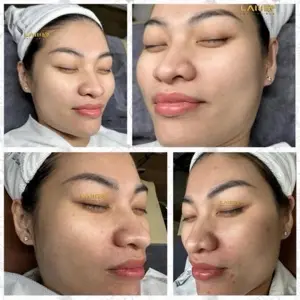 Plumping / Glossy Peel