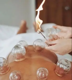 Supplement – Cupping & Infrared Therapy