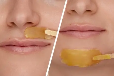 Waxing Lông Cằm (Nữ)