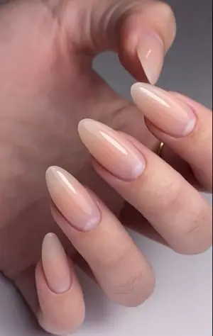 Lớp cứng móng