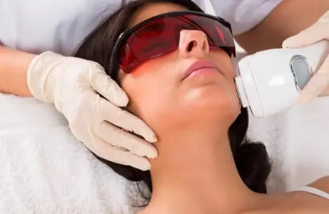 Face Hair Removal - 1 Year