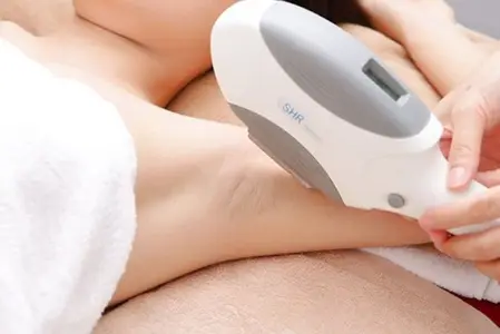 Underarm Hair Removal - 2 Years