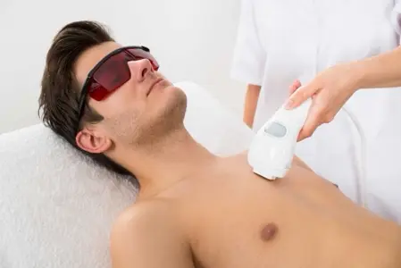 Chest Hair Removal