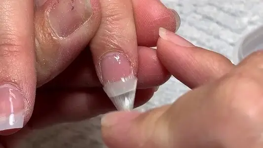 Nail Repair
