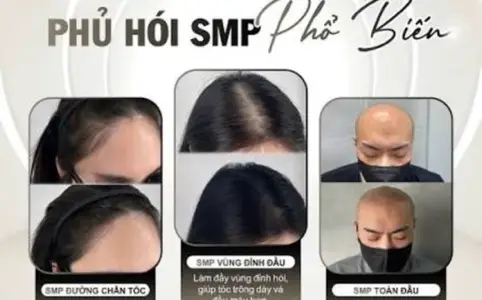 Half-head SMP / 1 session