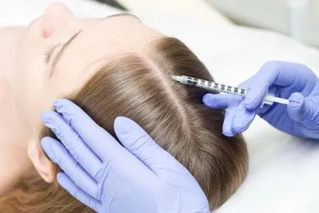 Exosome (Half head) / 1 session