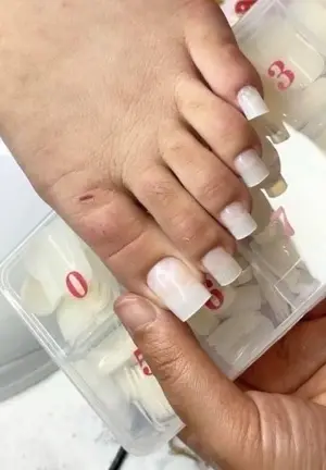 Úp móng chân – Cấp độ cơ bản