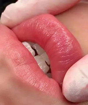 Phun môi