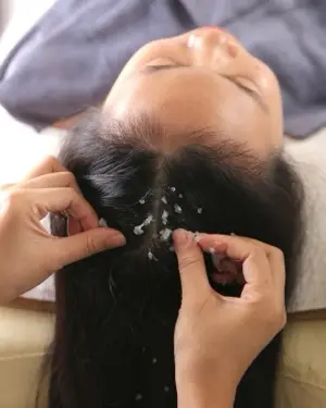 Tẩy da chết đầu