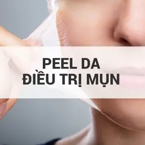 Acne Treatment Peel
