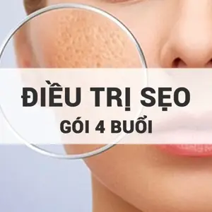 Advanced Scar Treatment
