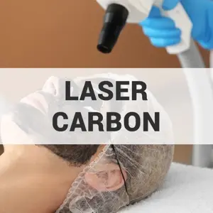 Carbon Laser for Melasma