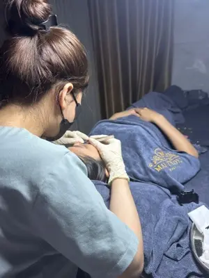 Mụn nano Acnes