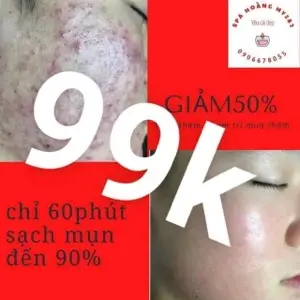 Acne Extraction