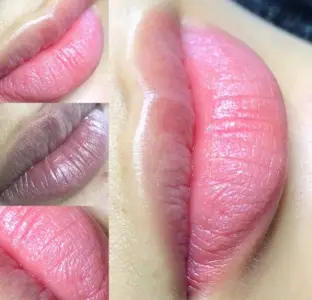 Lip Dark Spot Removal With Cotton Swab - Copy