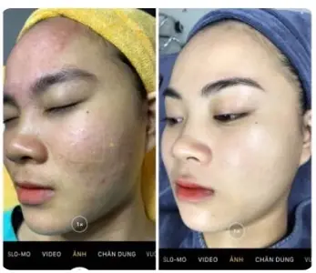 Weak Skin Recovery