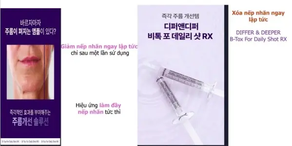 XOÁ NHĂN LÀM ĐẦY BẰNG BOTOX