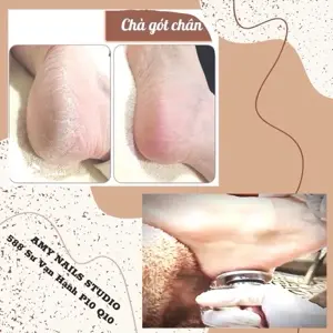Chà gót