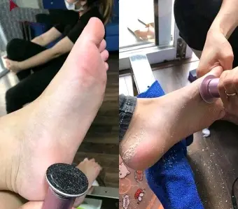 Foot heel scrubbing