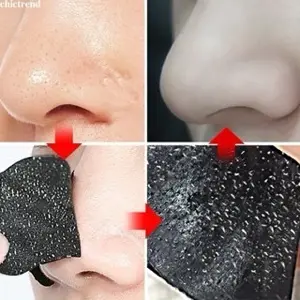 Blackhead Extraction