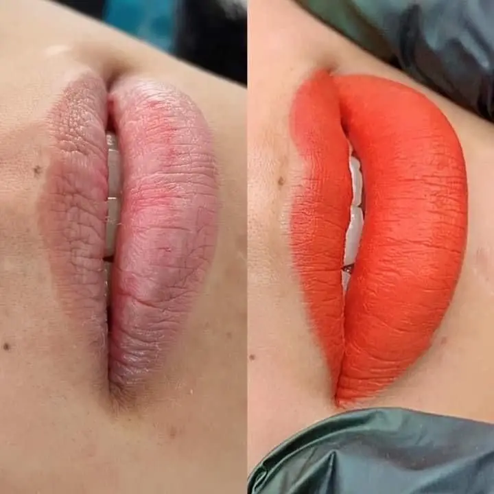 Tuyết Hà -Nối Mi+ Phun Xăm+ vua trị mụn
