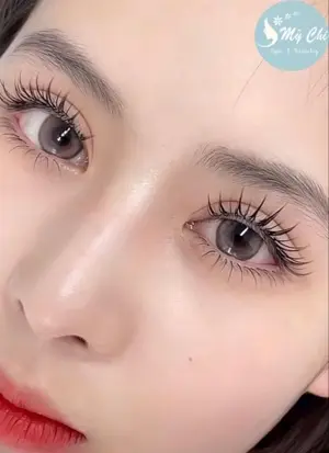 Nối mi