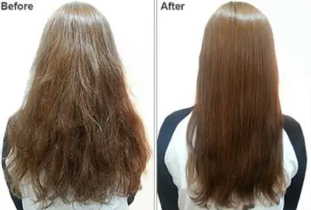 Hair Recovery
