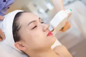 Triệt Mép ( 600k/lần )