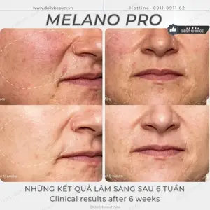 MELANOPRO - LOẠI BỎ SẮC TỐ