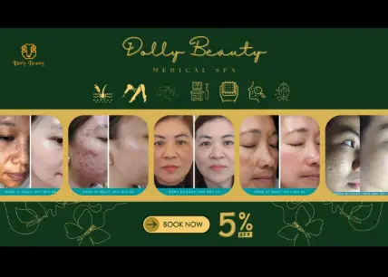 DOLLY BEAUTY - Chăm da chuẩn y khoa